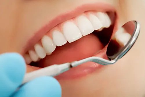 Cosmetic Bonding & Reshaping treatment visual at Smiles for All Dental Clinic