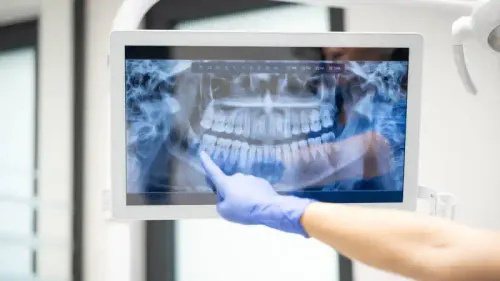 Digital X-Ray Diagnostics treatment visual at Smiles for All Dental Clinic