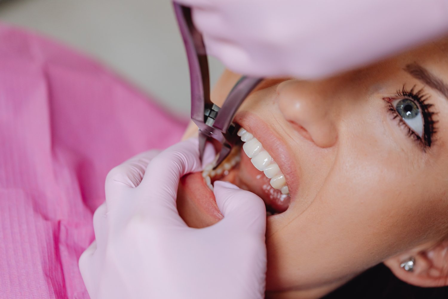 Extractions & Oral Surgery treatment visual at Smiles for All Dental Clinic